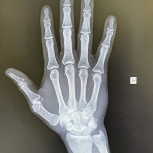 Meet your Posher, King david